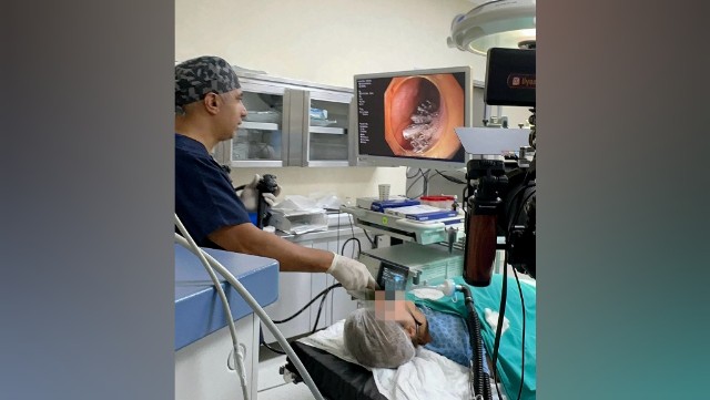 Peroral Endoskopik Miotomiya Diaqnoz Tibb Mərkəzində icra olunur! - VİDEO